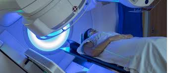 external beam radiation therapy