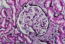 Glomerular Capillary Basement Membrane