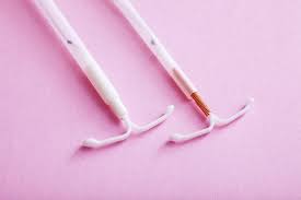 iud removal what to expect new age
