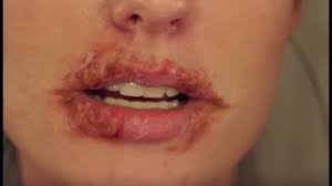 cold sore herpes sfx halloween makeup