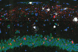 researchers map brain cell changes in