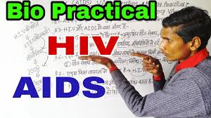 hiv aids viva questions biology
