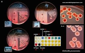 Klebsiella Pneumoniae Colony Morphology And Microscopic