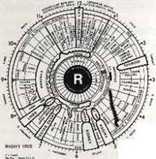 What Is The Chart Iridology Karels Nutrition Blog
