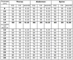 68 Reasonable Radiology Kvp And Mas Chart
