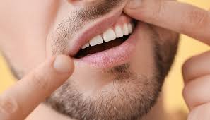 gum disease treatment home remes