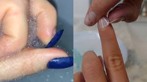 naturally remove stubborn acrylic nails