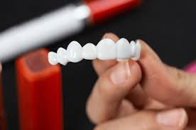 Diy veneers are dental appliances that anyone can buy online. What Are Diy Veneers And How Do They Work The Teeth Blog