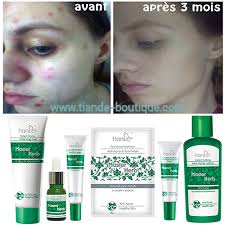 masque visage anti acné anti
