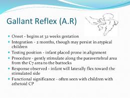 Neonatal Reflexes By Baneet
