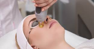 laser treatments in singapore