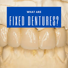 fixed dentures chicago dental implants