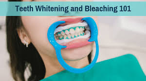 teeth whitening and bleaching 101