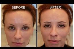 semi permanent makeup treatment in