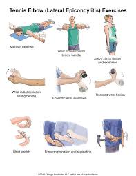 How To Get Rid Of Tennis Elbow Tennis Elbow Stretches