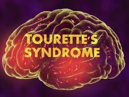 new treatment for tourette s what to