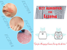 Best Humidifier For Eczema Humidifier Mentor