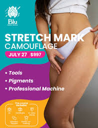 stretch mark camouflage cl july 27