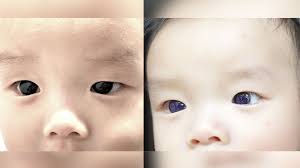infant s dark brown eyes suddenly turn