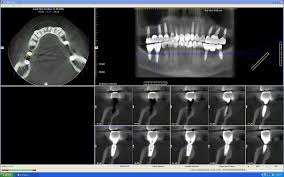 the safety of cone beam ct essential