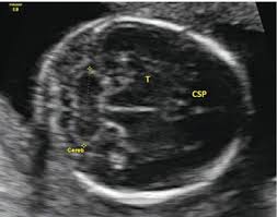 Growth Doppler And Fetal Assessment Radiology Key