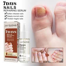 20ml fungal nail treatment oil foot