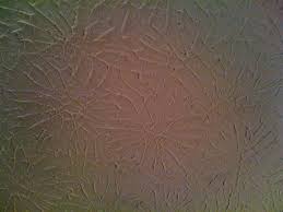 Rosebud Drywall Texture