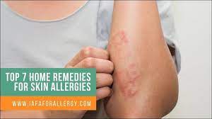 top 7 home remes for skin allergies