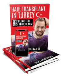 the ultimate hair transplant clinic
