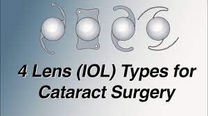 lens iol types for cataract surgery