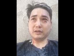The making of andy ngo. Andy Ngo Released From Hospital After Vicious Attack From Antifa