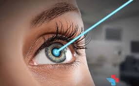 about lasik eye surgery