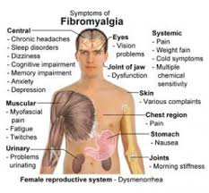 Fibromyalgia Pain Misdiagnosed And Growing In Numbers