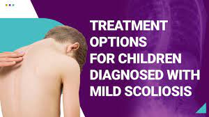 children diagnosed with mild scoliosis