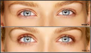 If you have an eye condition such as glaucoma. Latisse Eyelashes Where To Get Latisse Grow Longer Eyelashes
