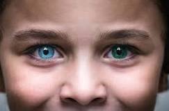 What is the rarest form of heterochromia?