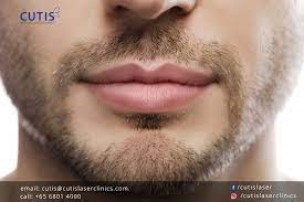 lip fillers what men can expect