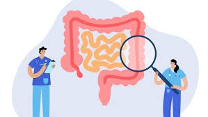 colorectal cancer can reduce risk