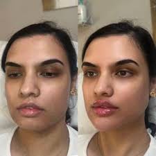 lips before after alluring image