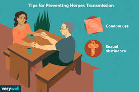 prevention of herpes and cold sores