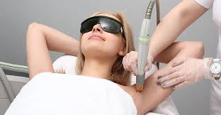 laser hair removal dermatology