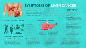 Having one or more of the symptoms below does not mean you have liver cancer. Liver Cancer Symptoms Causes Treatment Narayana Health