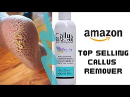 callus remover gel