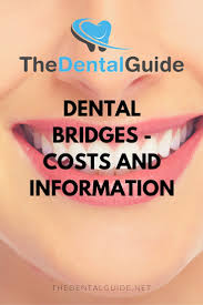dental bridges costs and information