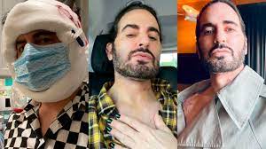 marc jacobs opens up about his facelift