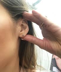 what it s like getting earlobe repair