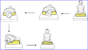 The home epley maneuver is an exercise you can try yourself to manage your symptoms caused by bppv. Modified Epley Maneuver For Treating Right Sided Bppv Download Scientific Diagram