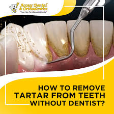 remove plaque tartar from teeth