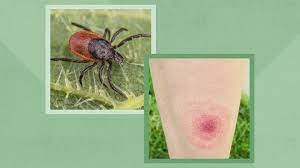 how ticks can make you sick plus
