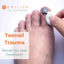 toenail trauma should you seek treatment